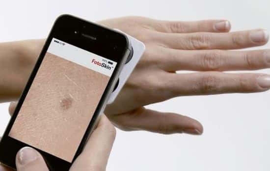 Aplicaciones dermatológicas para analizar manchas en la piel
